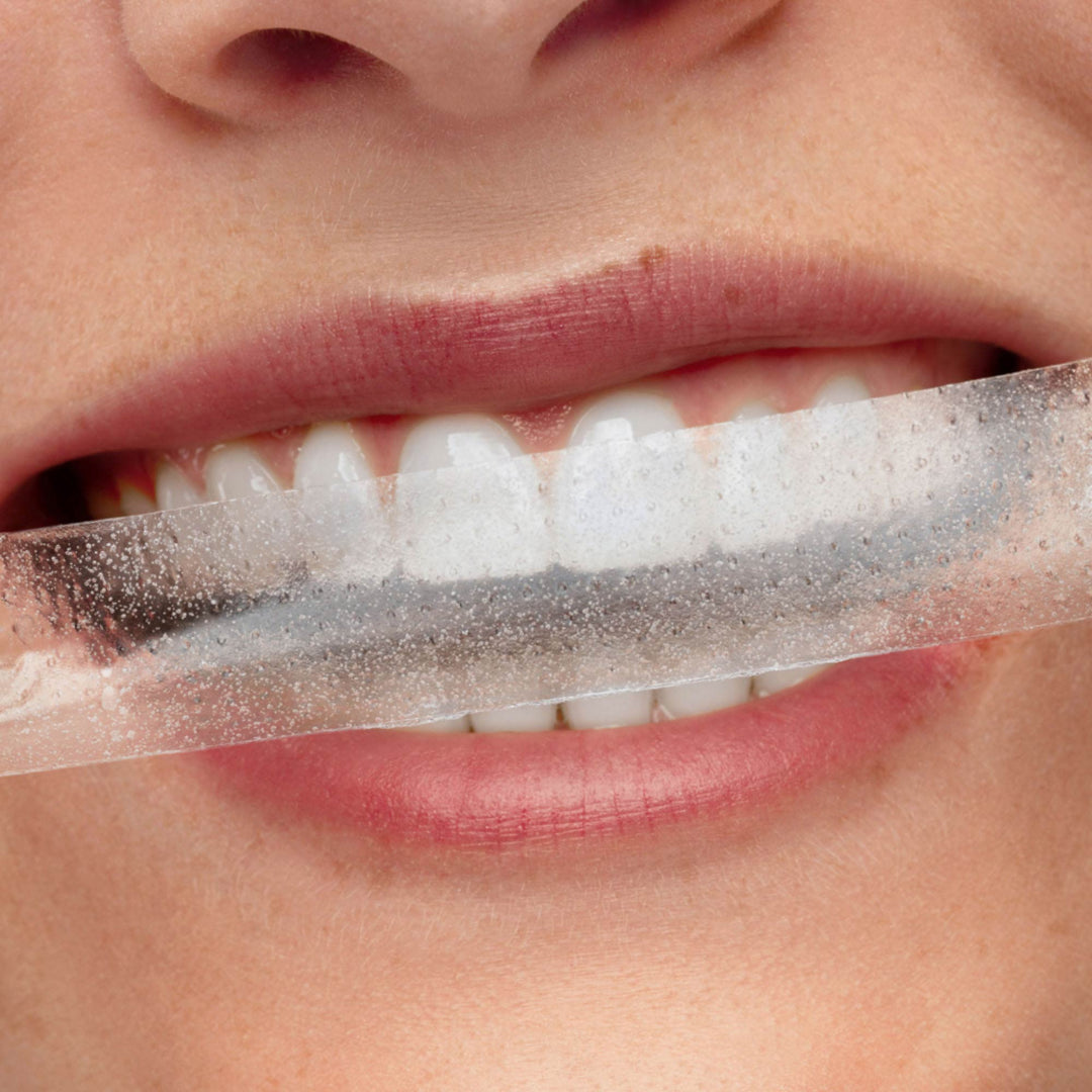 Smilepen Zahnaufhellungsstreifen Nacht