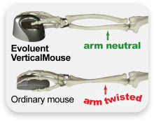 Evoluent Vertical Mouse4 Small Right Ergonomische Maus – kabelgebunden, programmierbare Tasten, schwarz