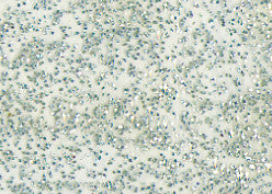 Marabu Fenstermalfarbe – Silber Glitter, 80 ml, für Glas & Porzellan